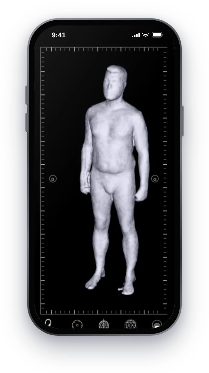 YouDome, 3D patient avatar on mobile